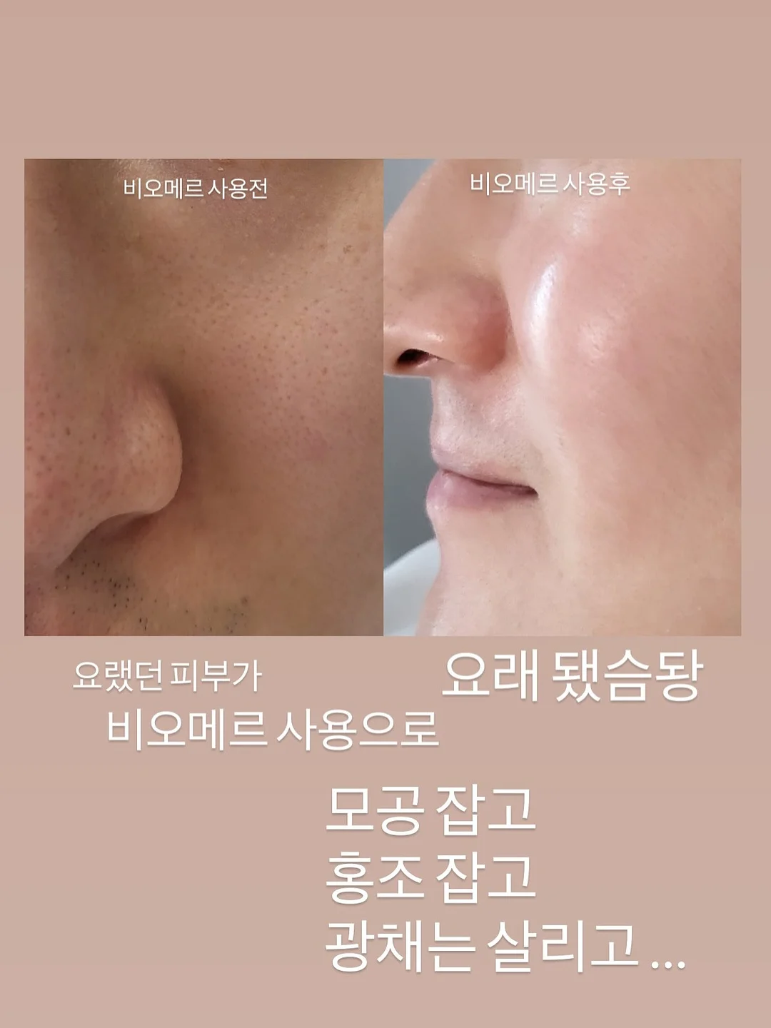 3초 보냉백 9