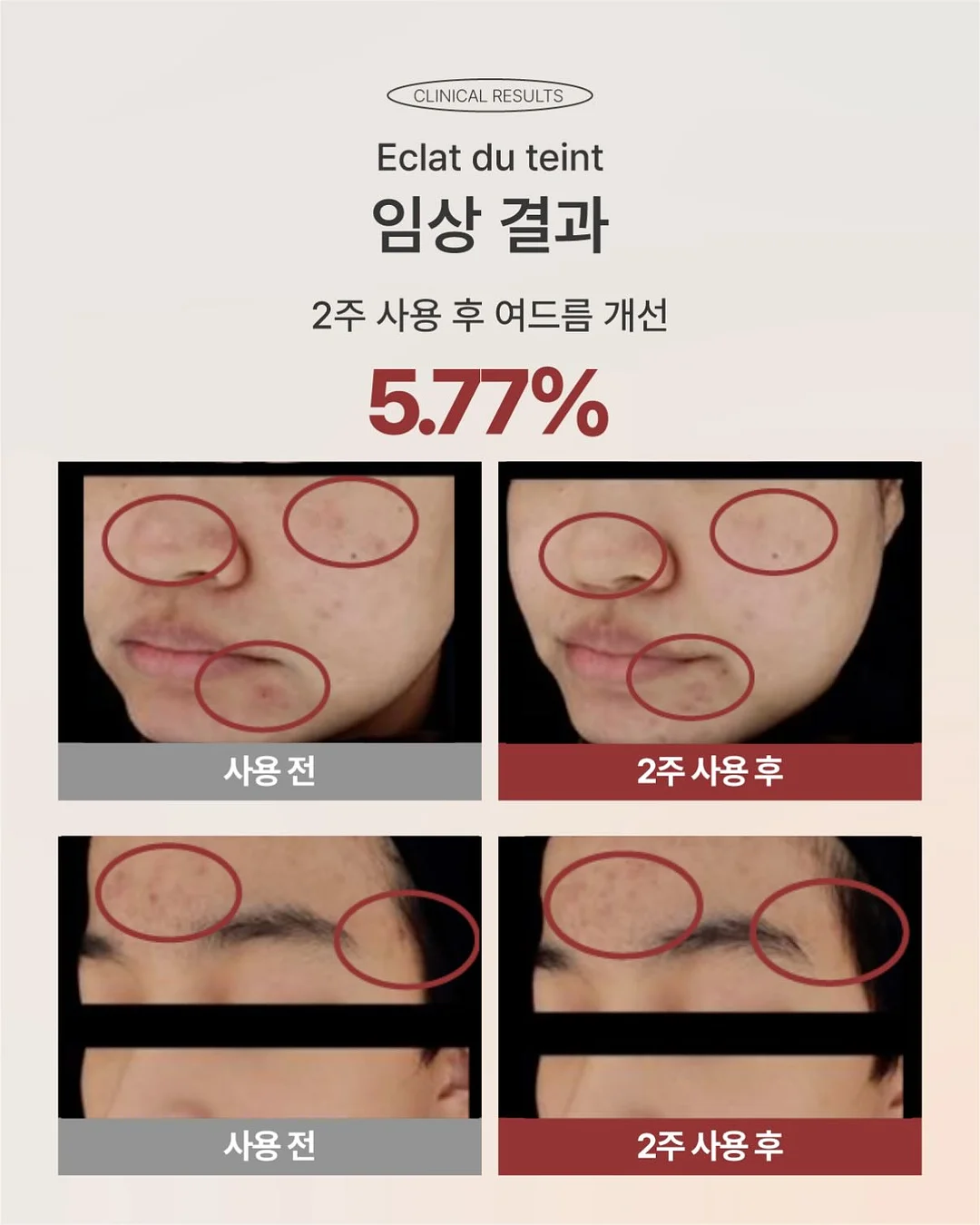 82+ 건조기반팔티 5