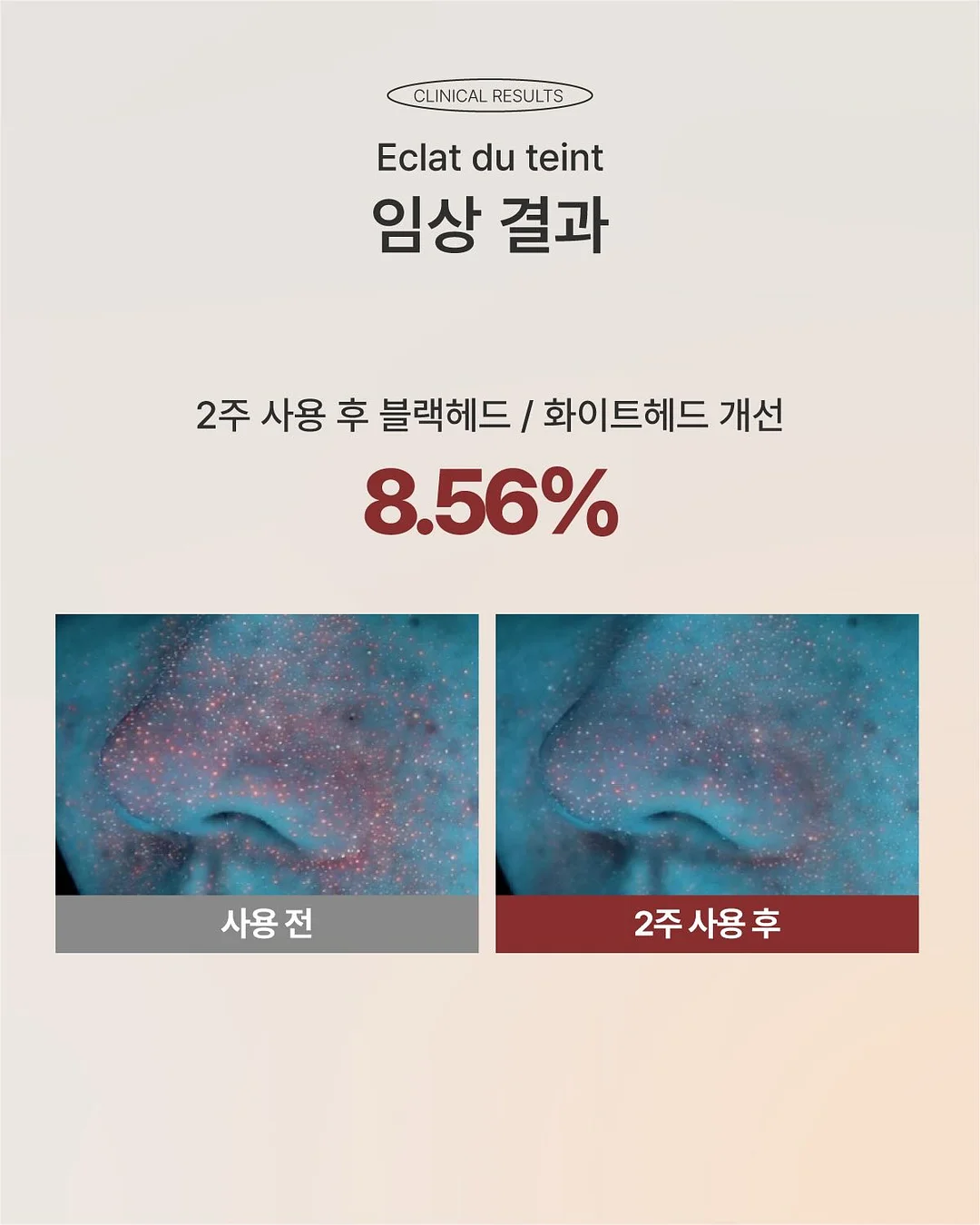 82+ 건조기반팔티 6