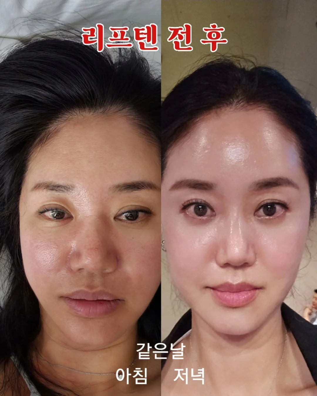 빈아미고 칠러 4