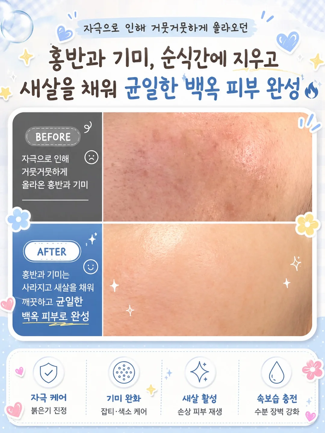 발렌자수롱원피스 2