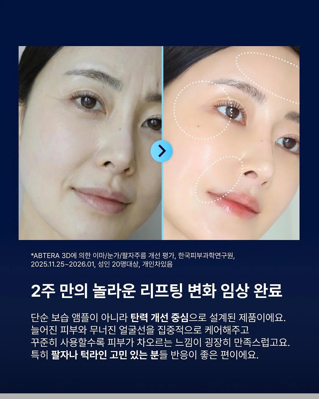IGT 테이블 수납 확장 모듈 3