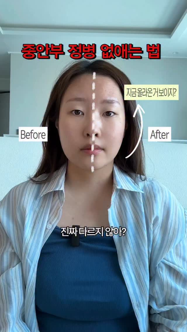 필라이트