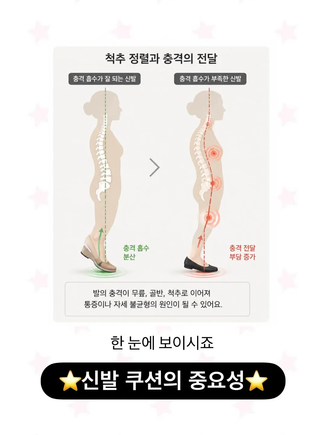 루나백 4