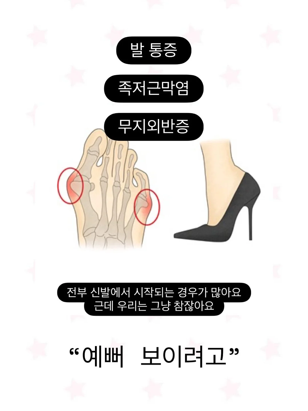 루나백 5