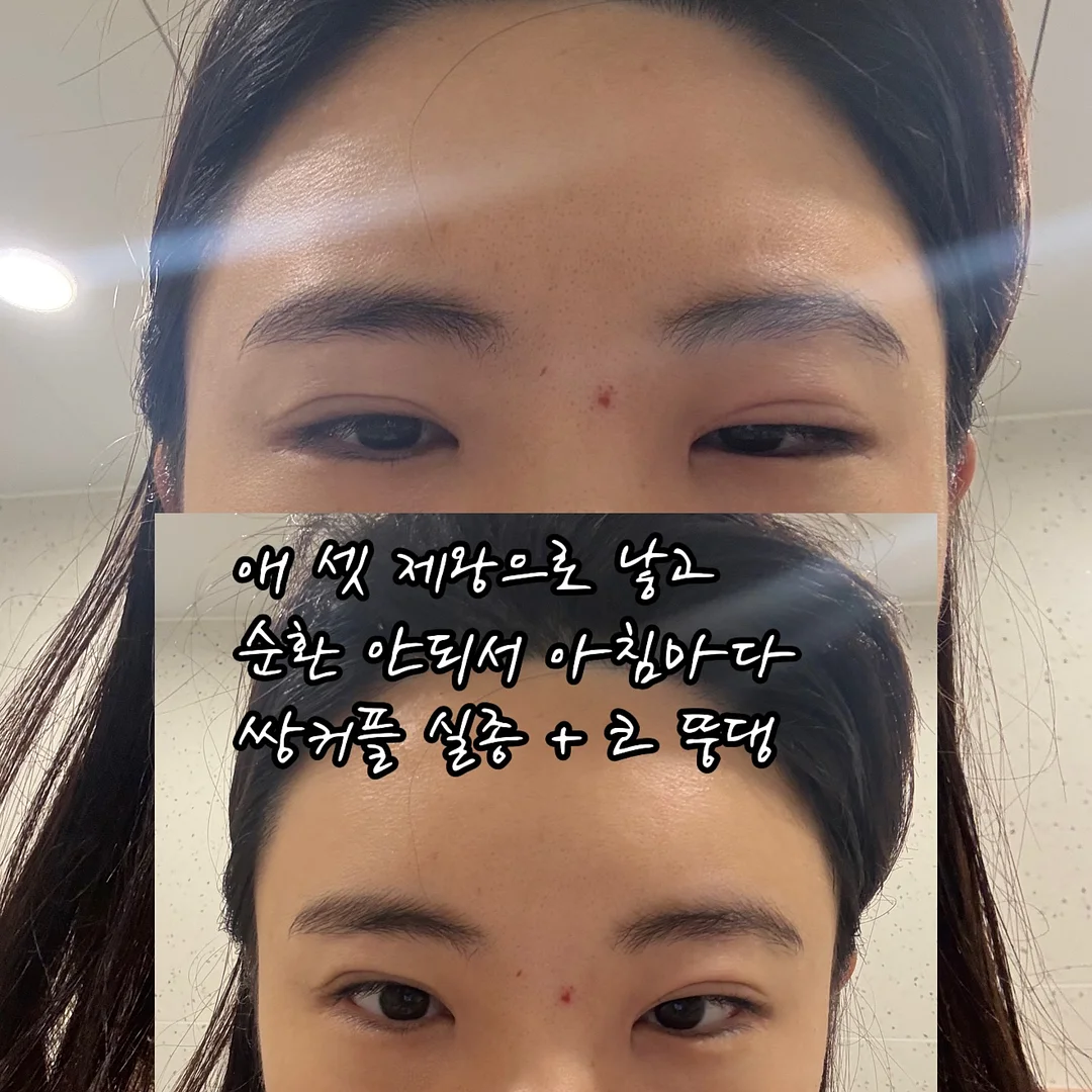 아임비타 비타 아미노젤 1