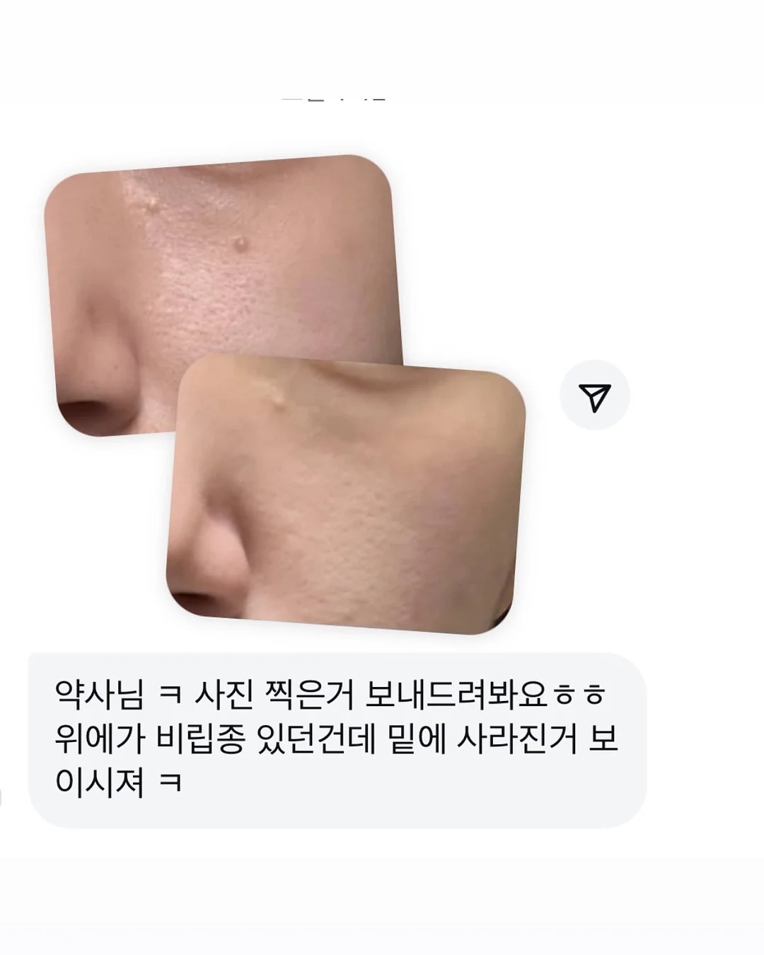 수동 착즙기 18
