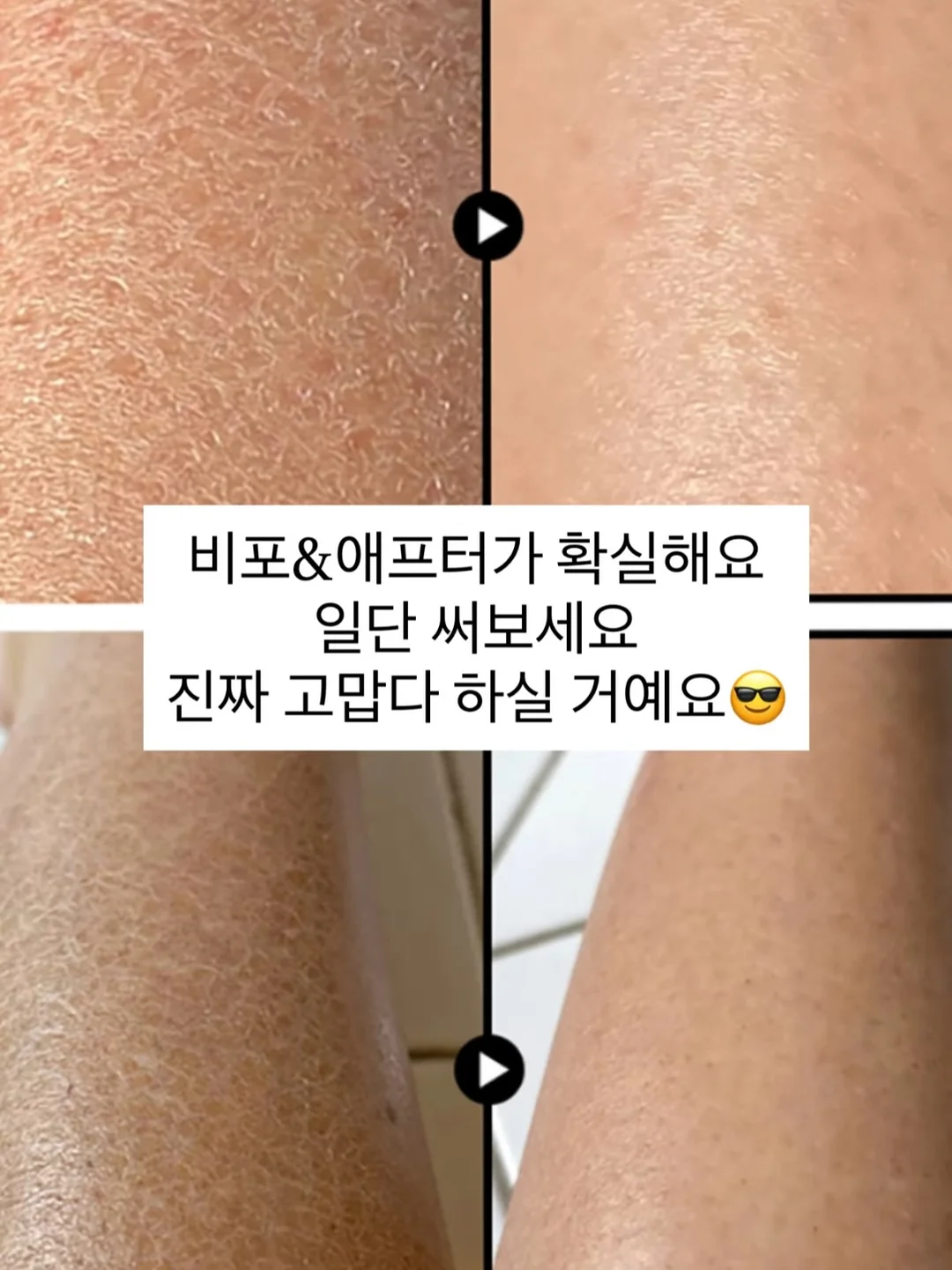 보톡 6