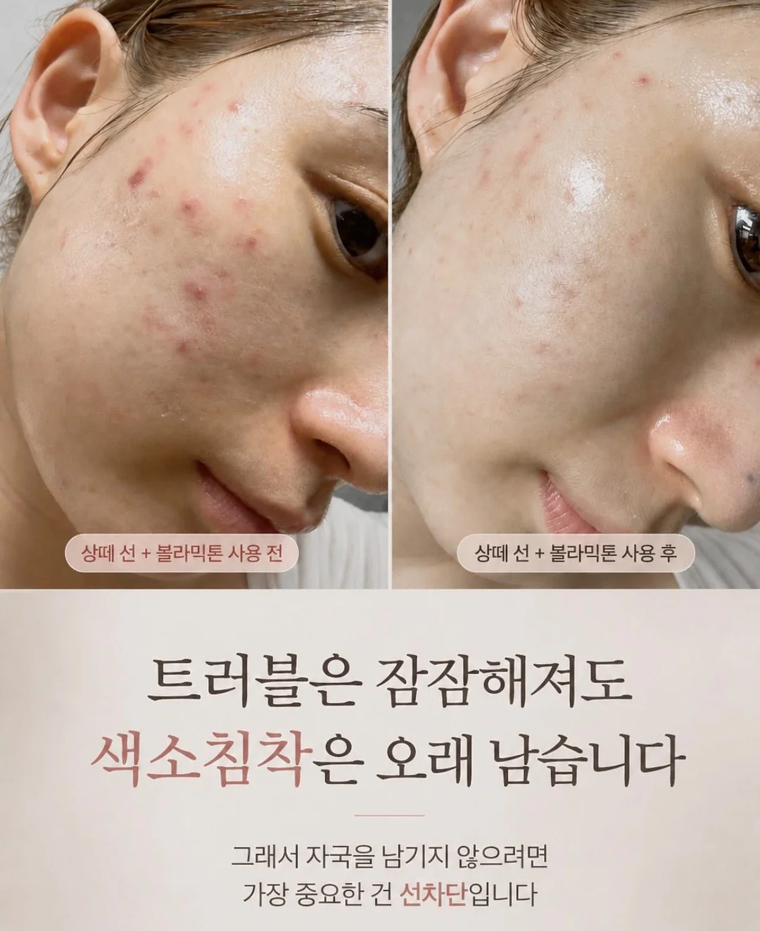 반쪽 레이스 양말 12