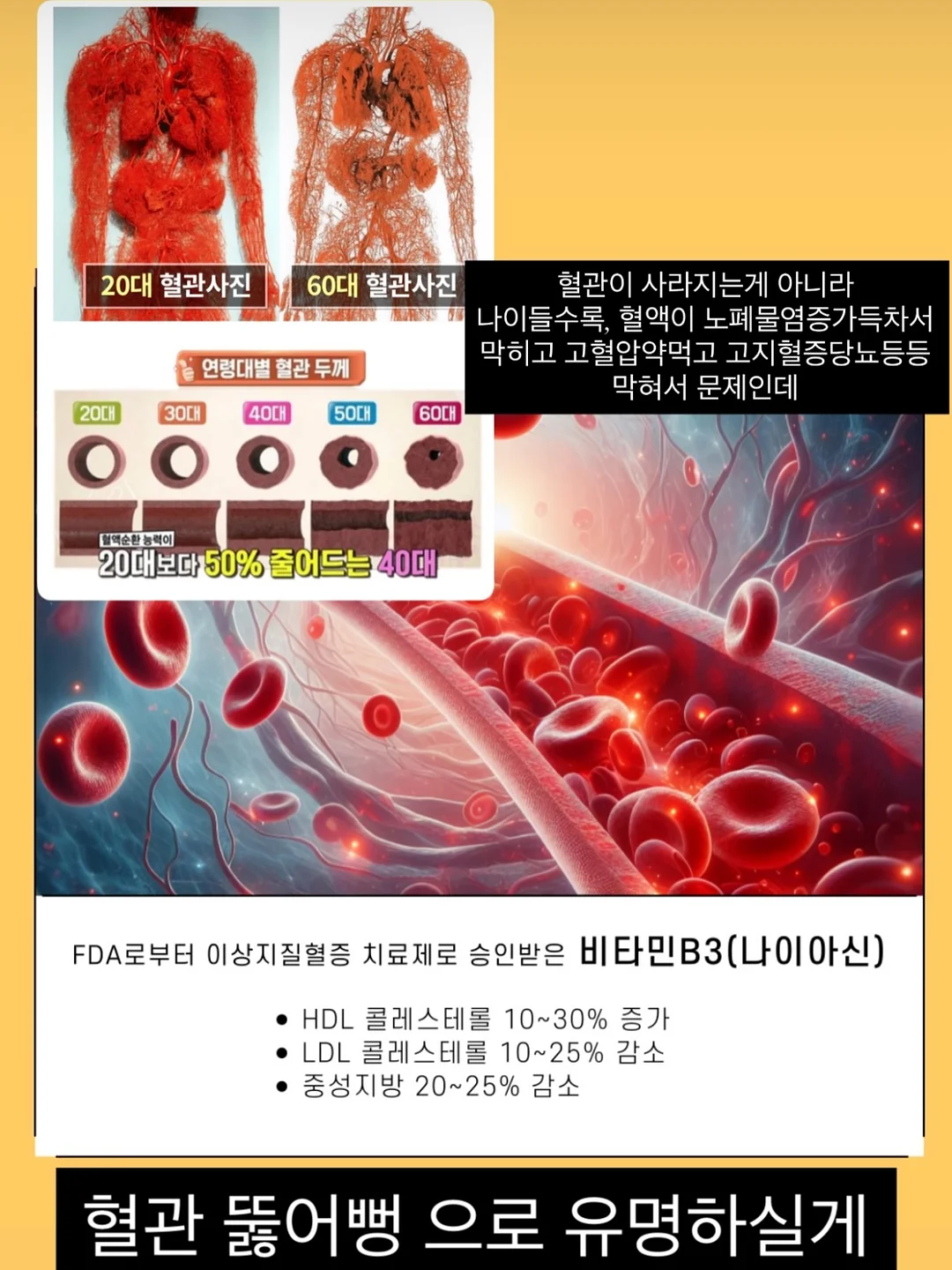 하이뮨 루테인 지아잔틴 아스타잔틴 4