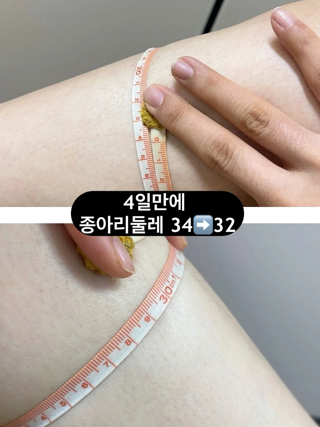 아크로 실링팬 2