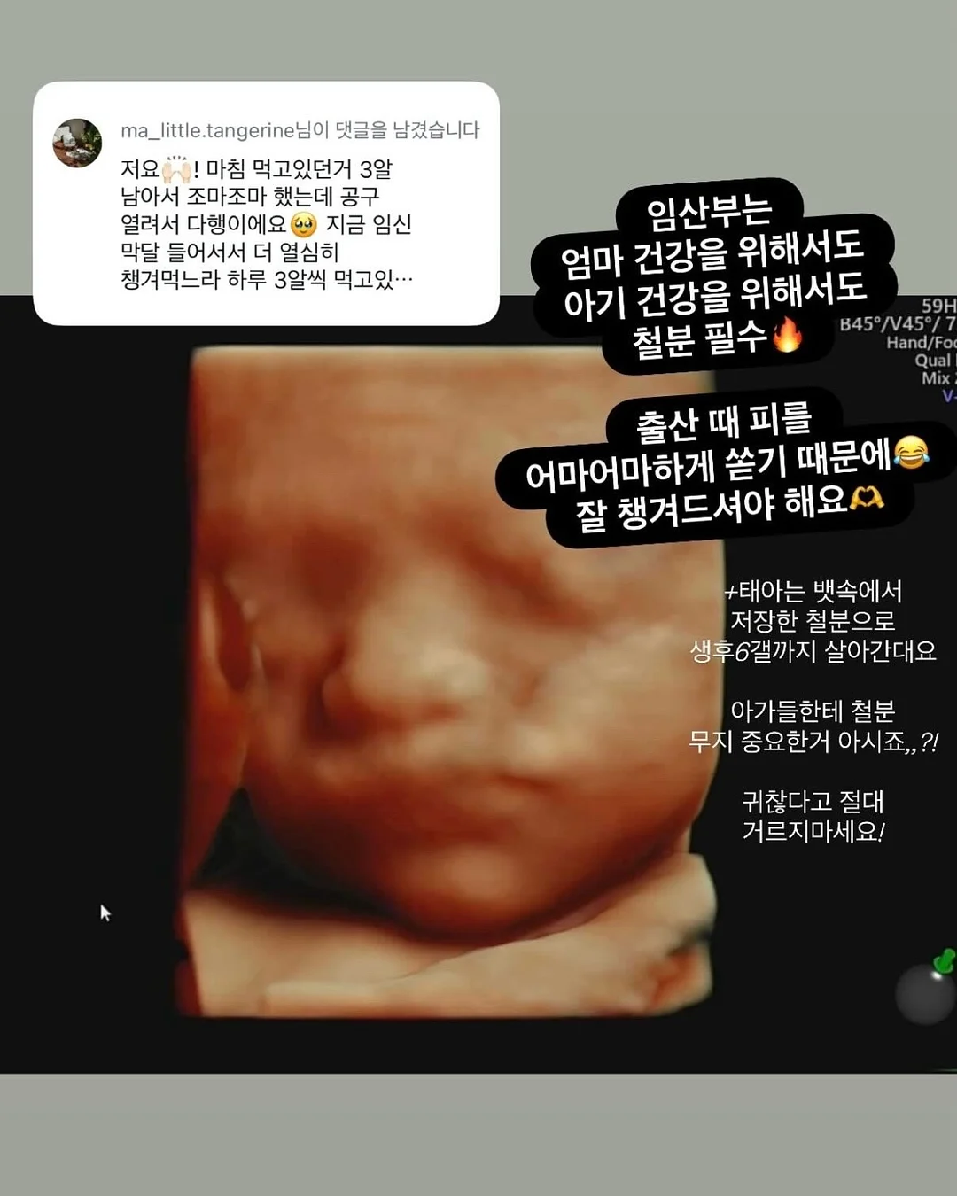 세면대 물때 제거 아이템 16