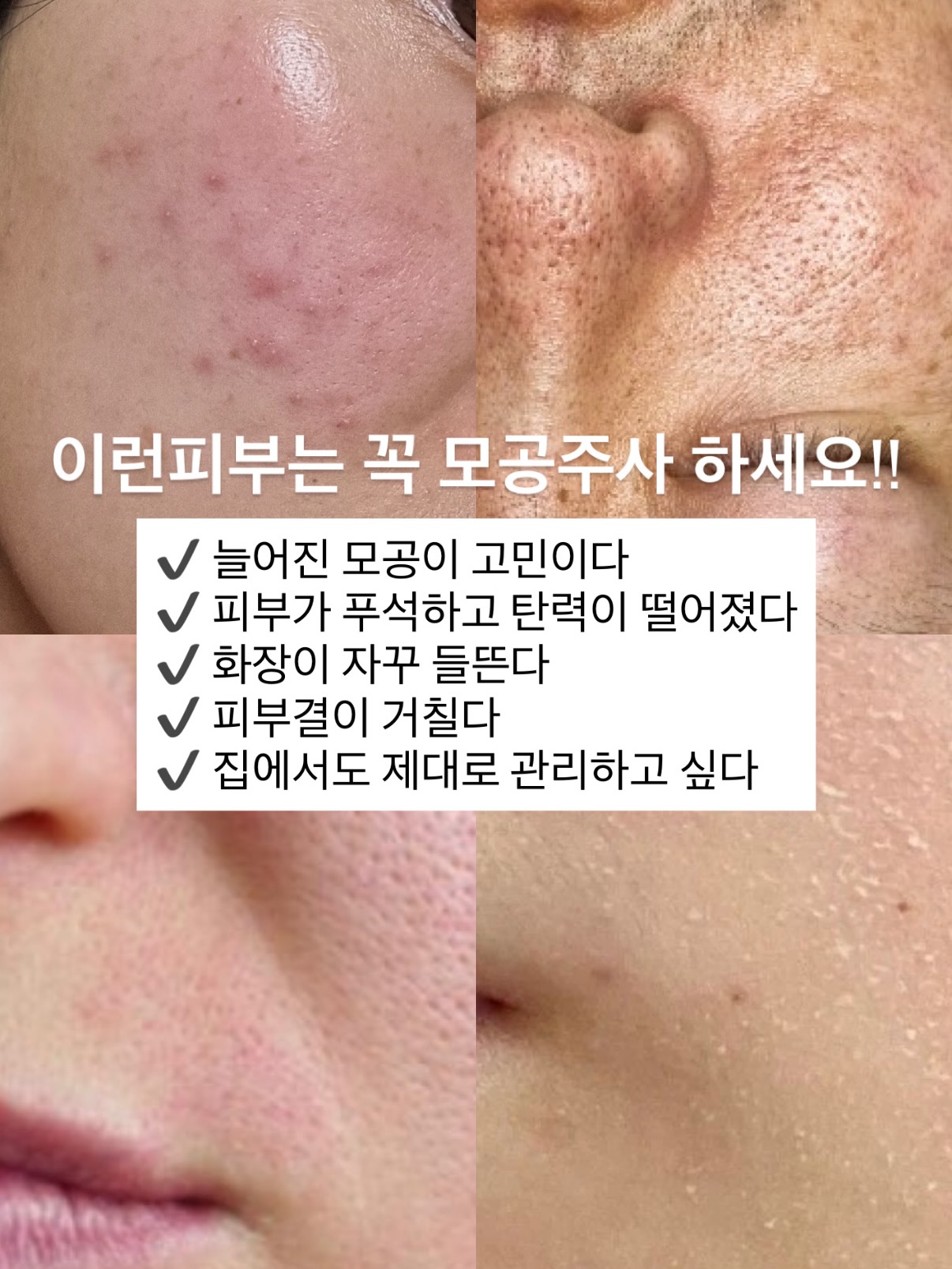 래쉬클리닉 래쉬케어시스템 리뉴얼 2