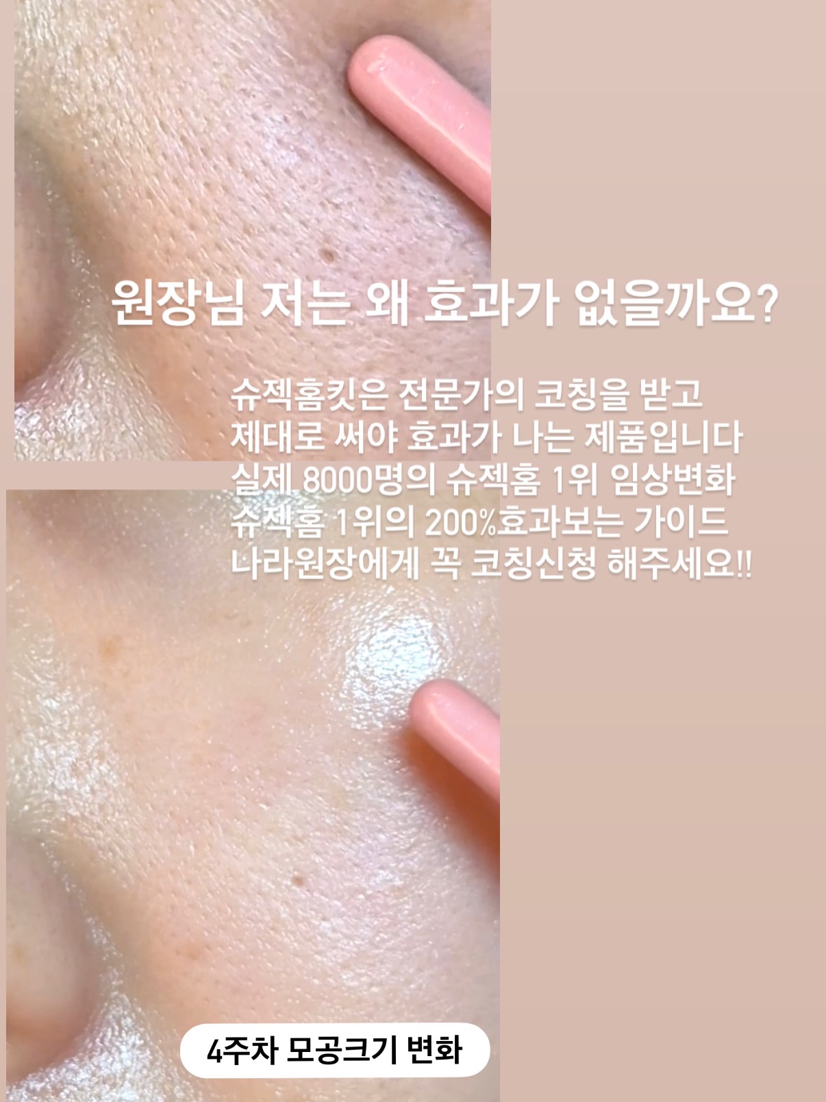 래쉬클리닉 래쉬케어시스템 리뉴얼 4