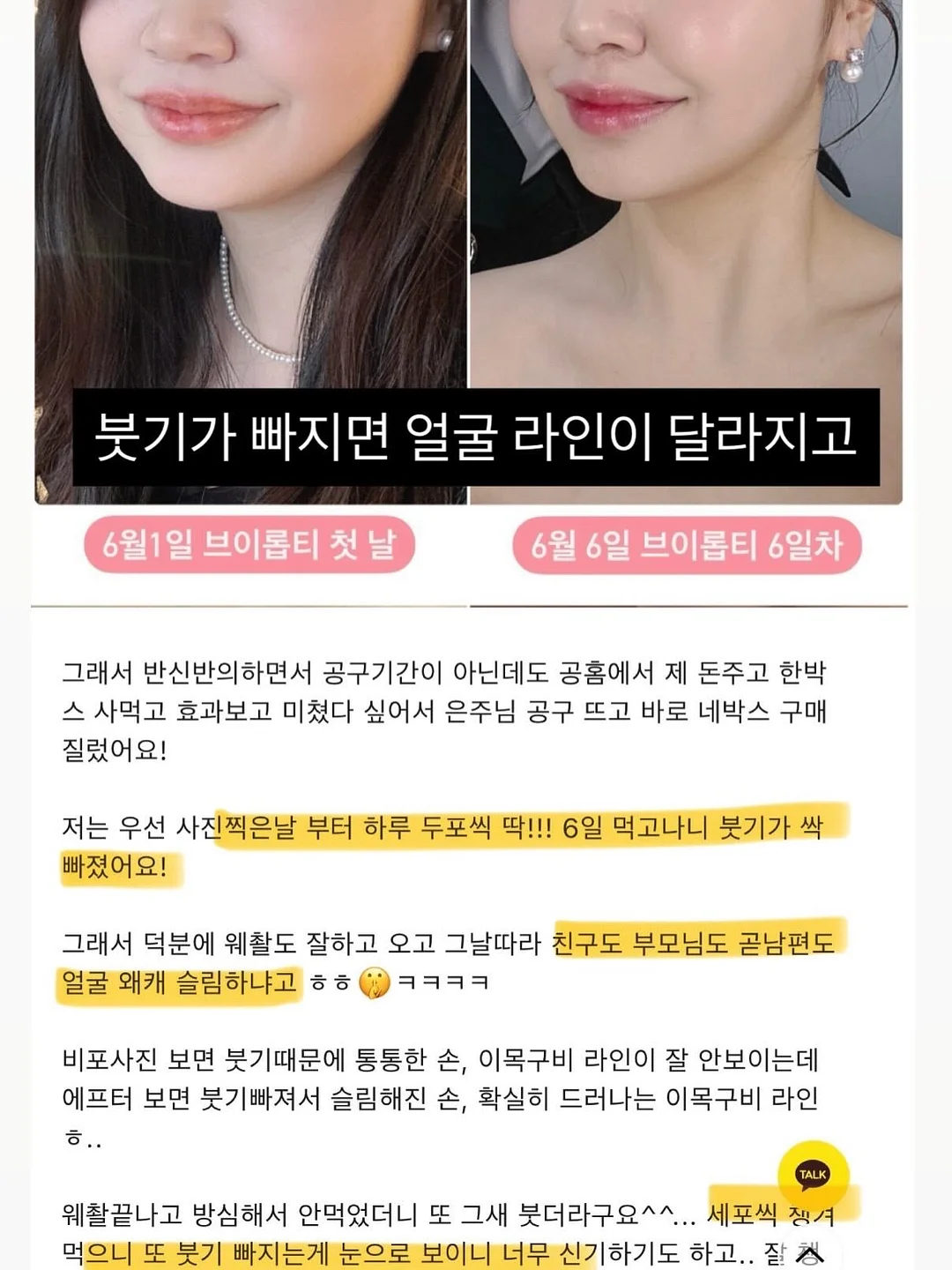 아기옷 6