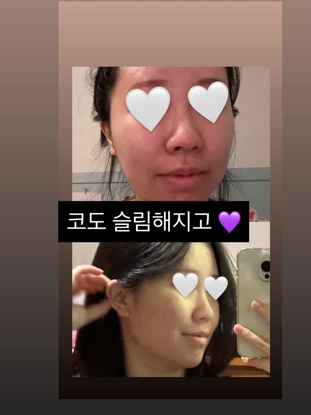 아기옷 8