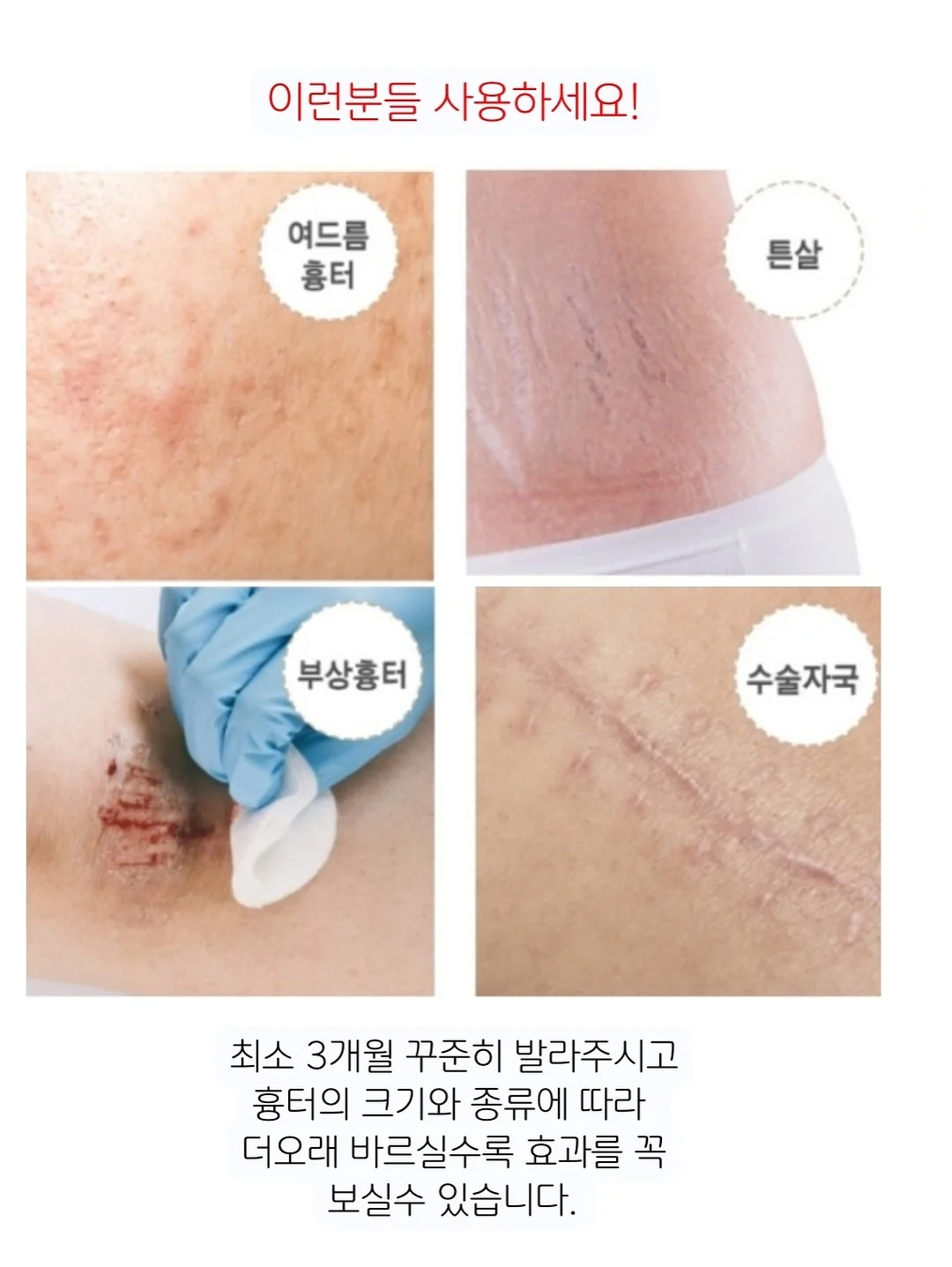 체리 생크림 클리커 키링 11