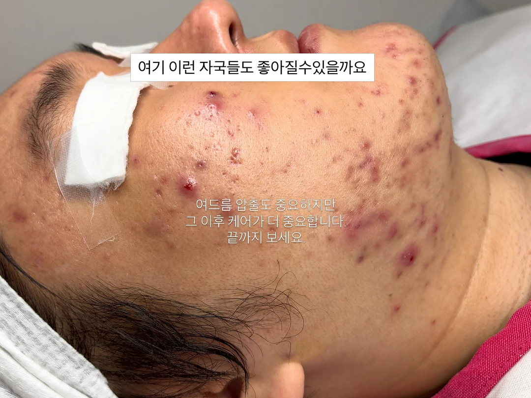 부스터큐 1