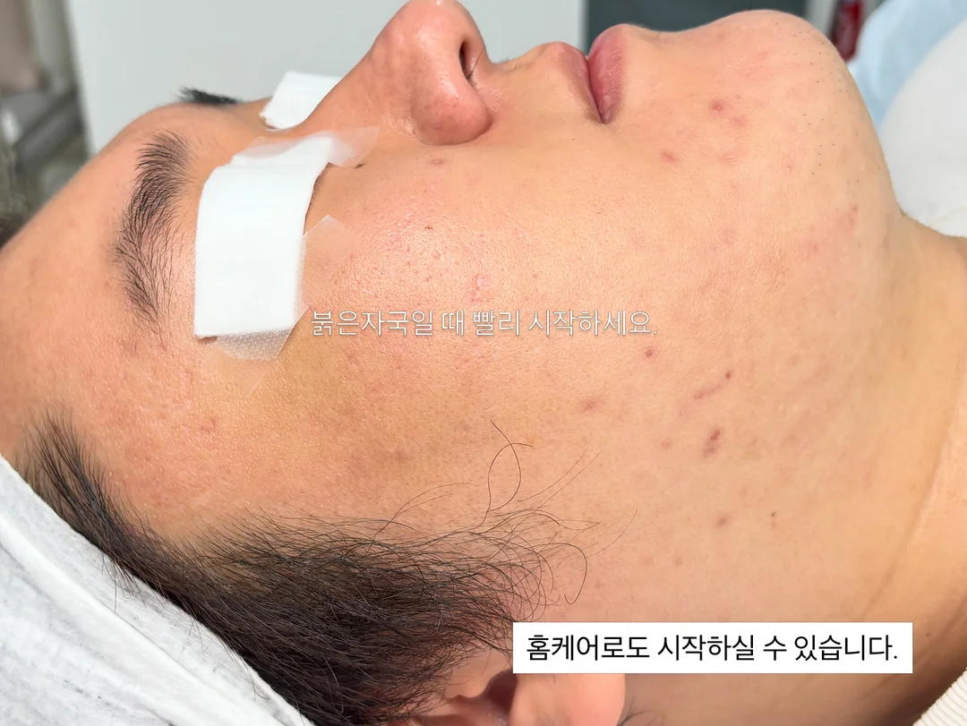 부스터큐 2