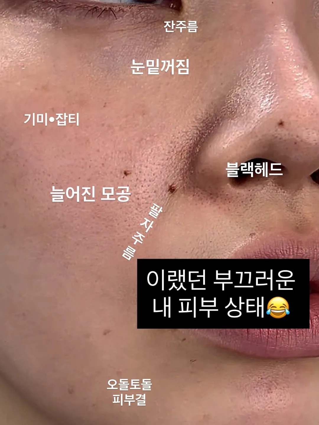 조이키토 방광 수비 레시피 2