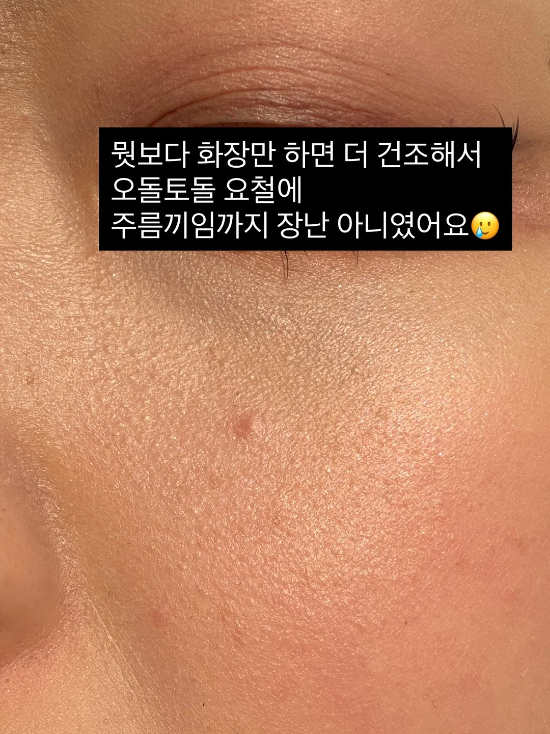 조이키토 방광 수비 레시피 4