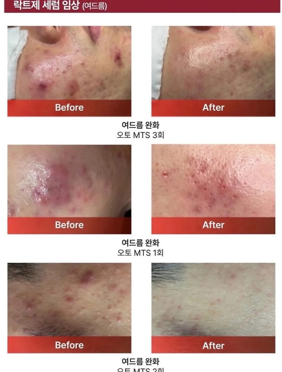 탄성인간 3