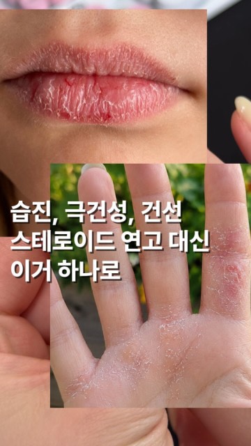 자켓