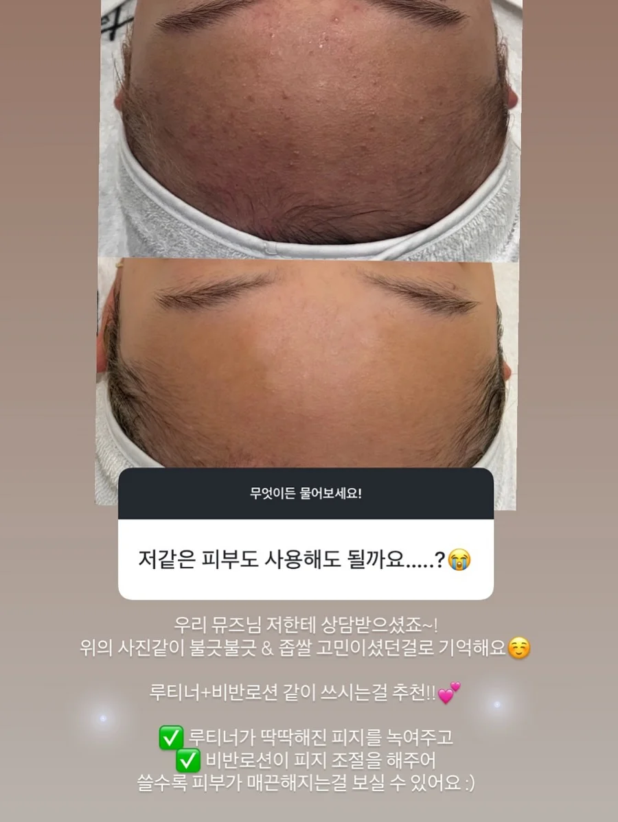 테리 배색 자켓 + 캉캉 스커트 셋트 1