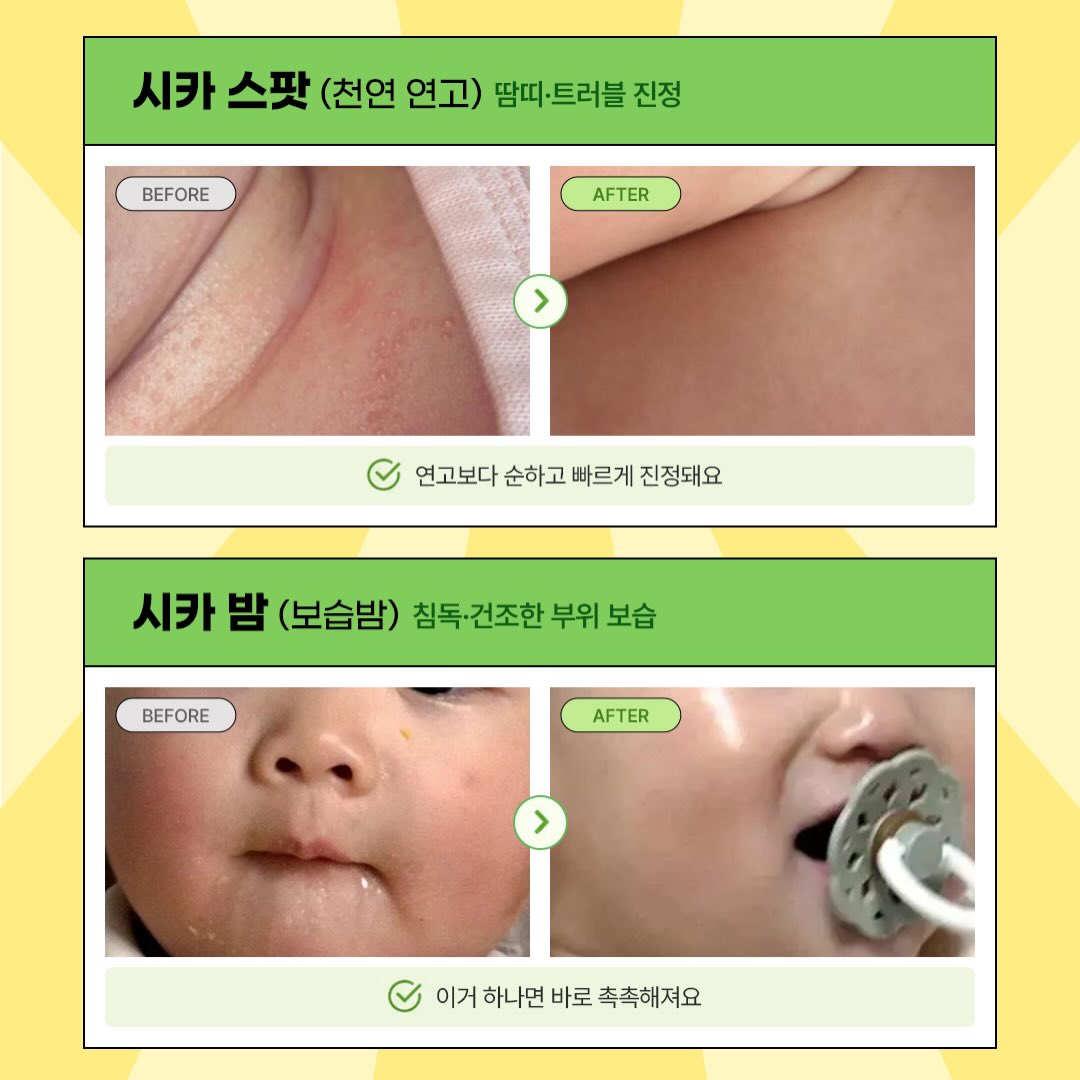 식기 14p 세트 4