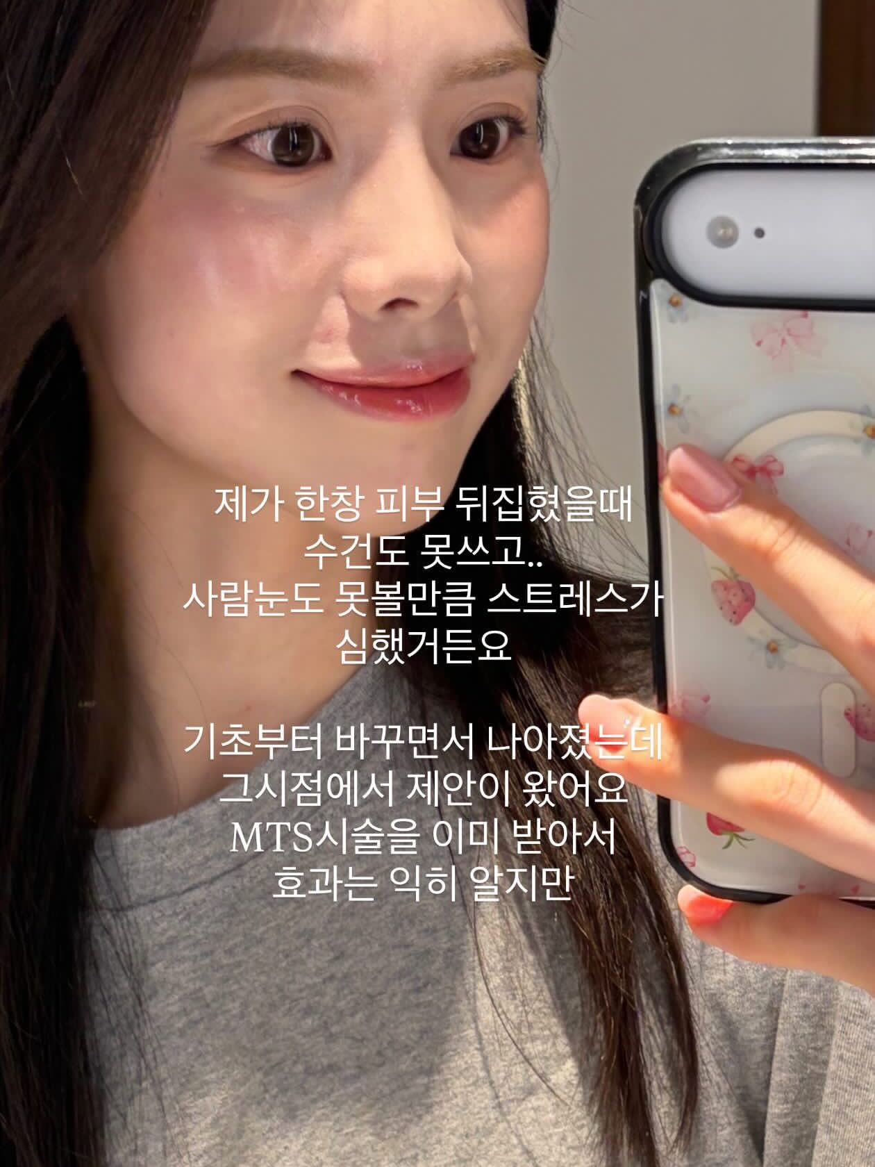 코팅 점퍼 7