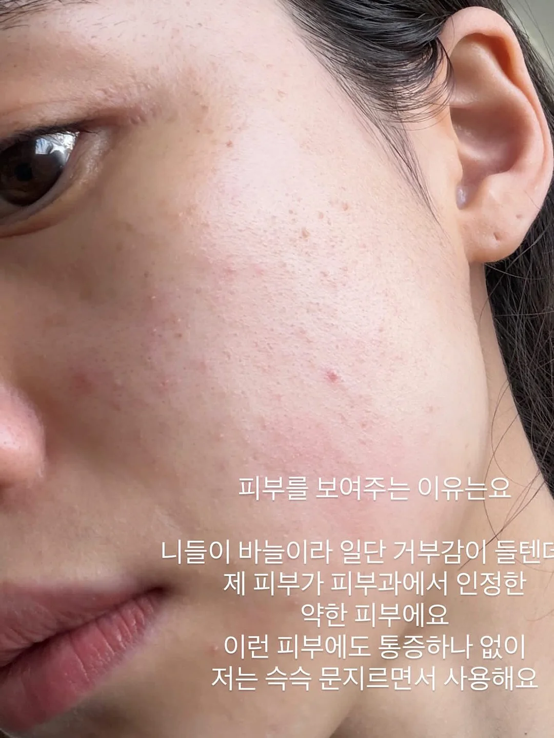 코팅 점퍼 10