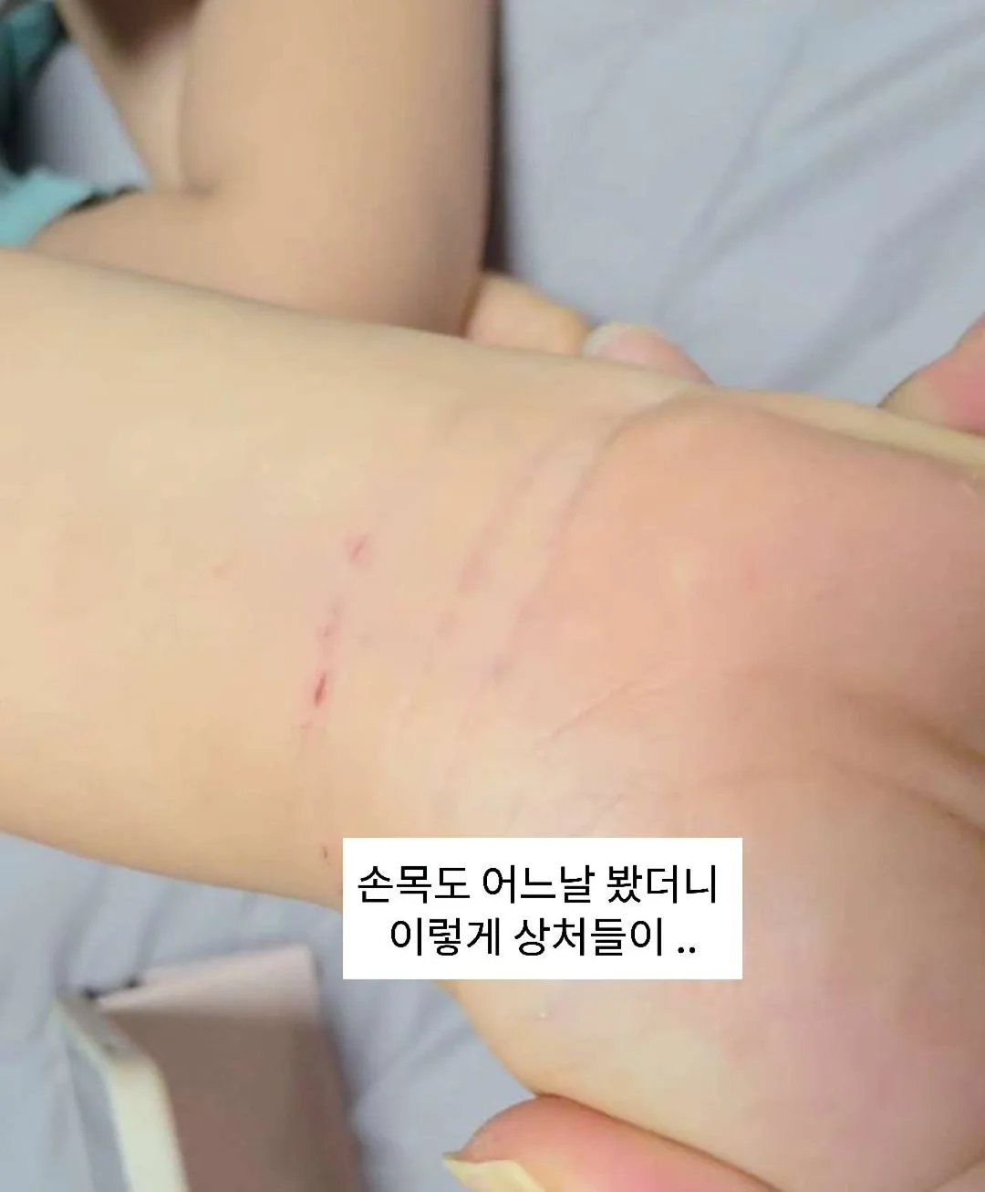 멜라오프밤 1
