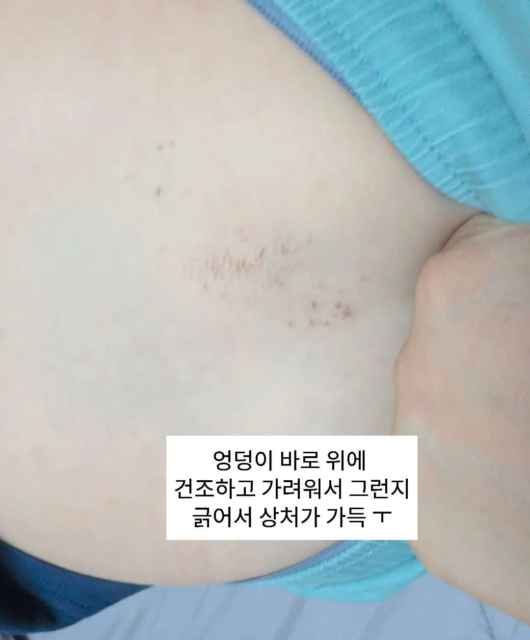 멜라오프밤 3