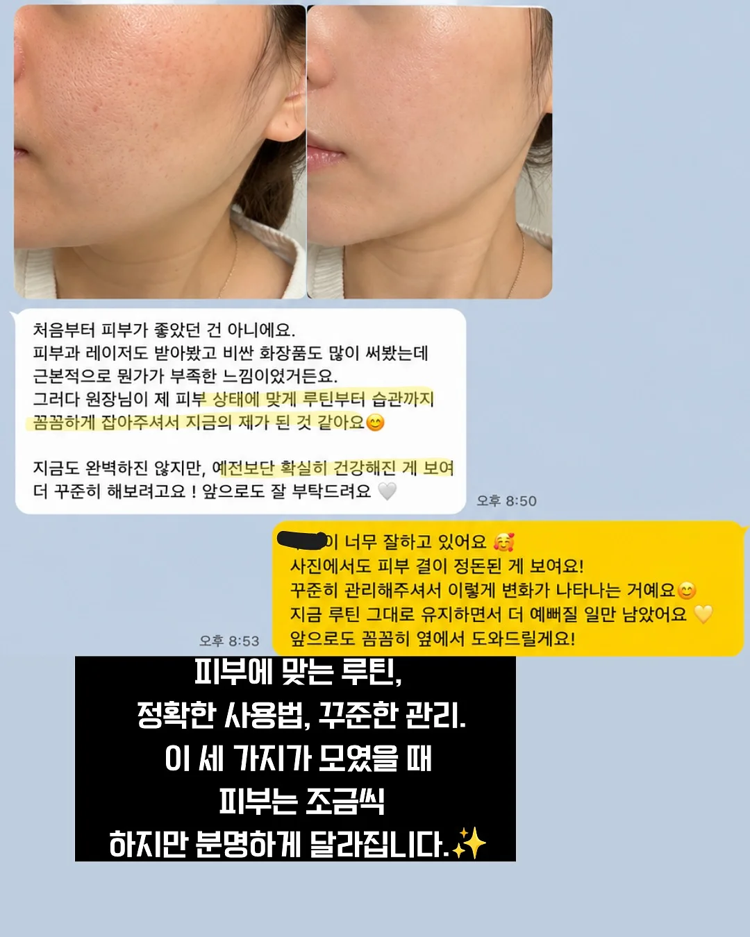 신비복숭아 5kg 12