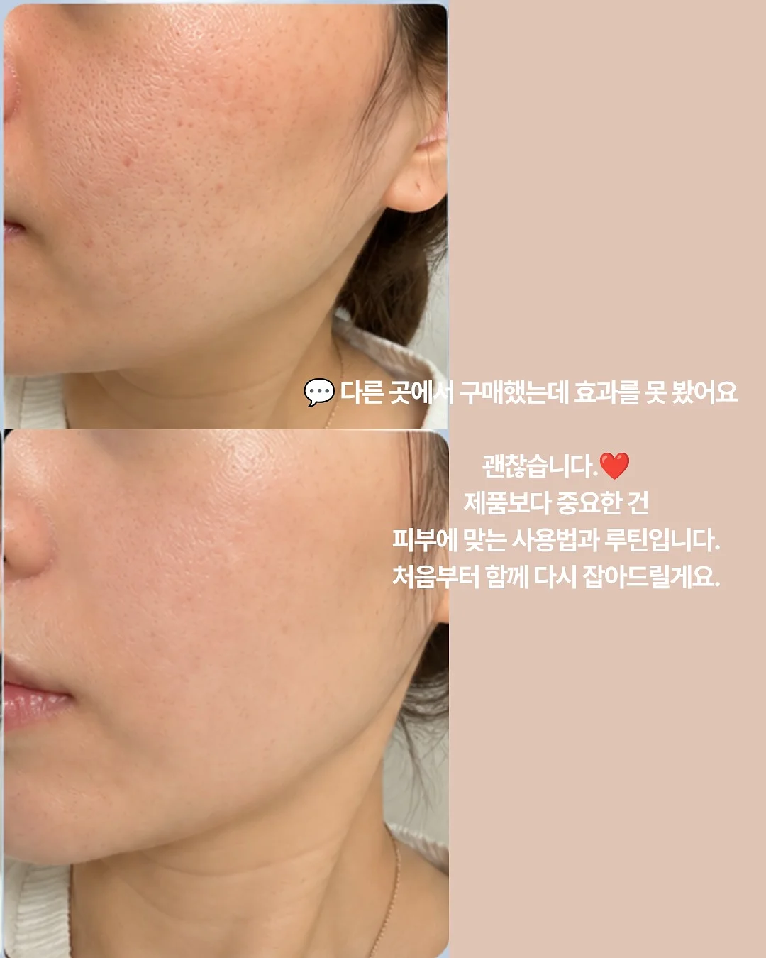 신비복숭아 5kg 9