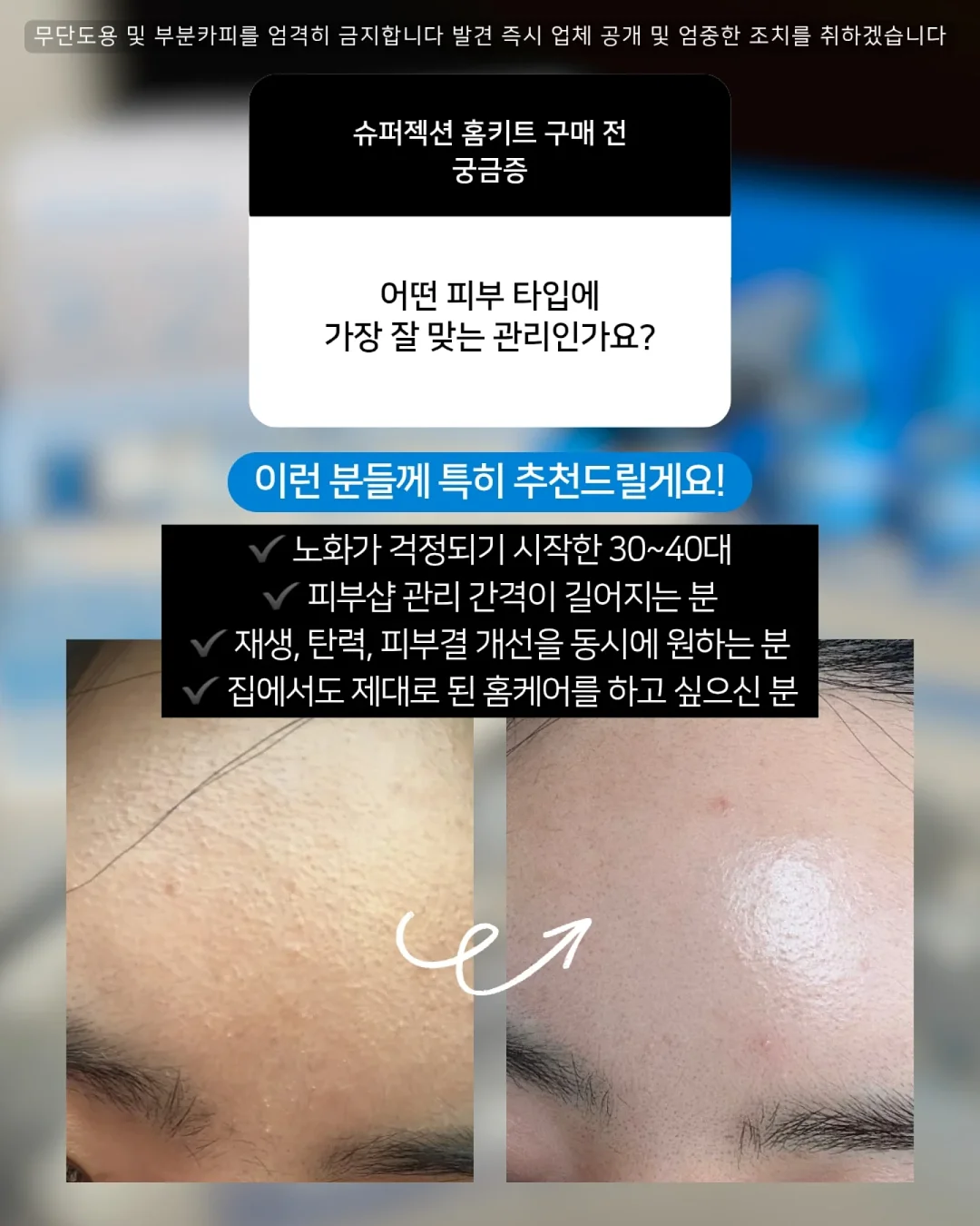 키티네일 필름 2