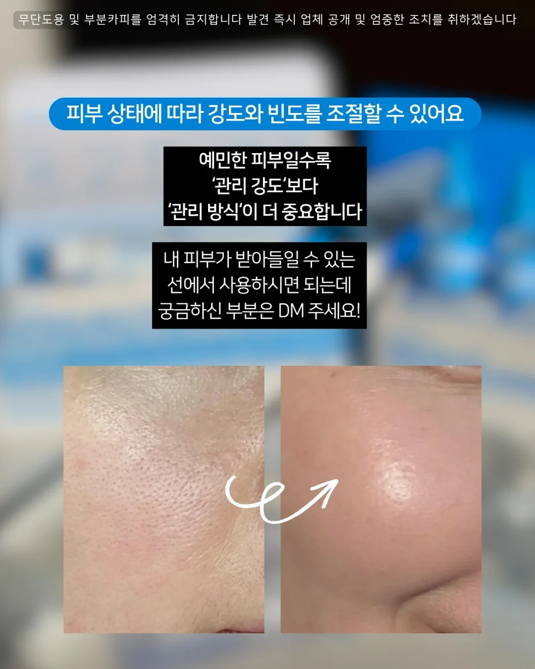 키티네일 필름 5