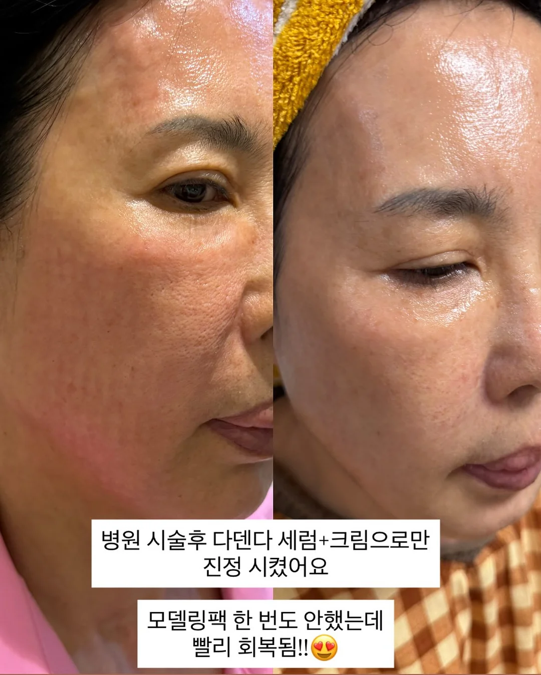 방구석 홈트 기구 2