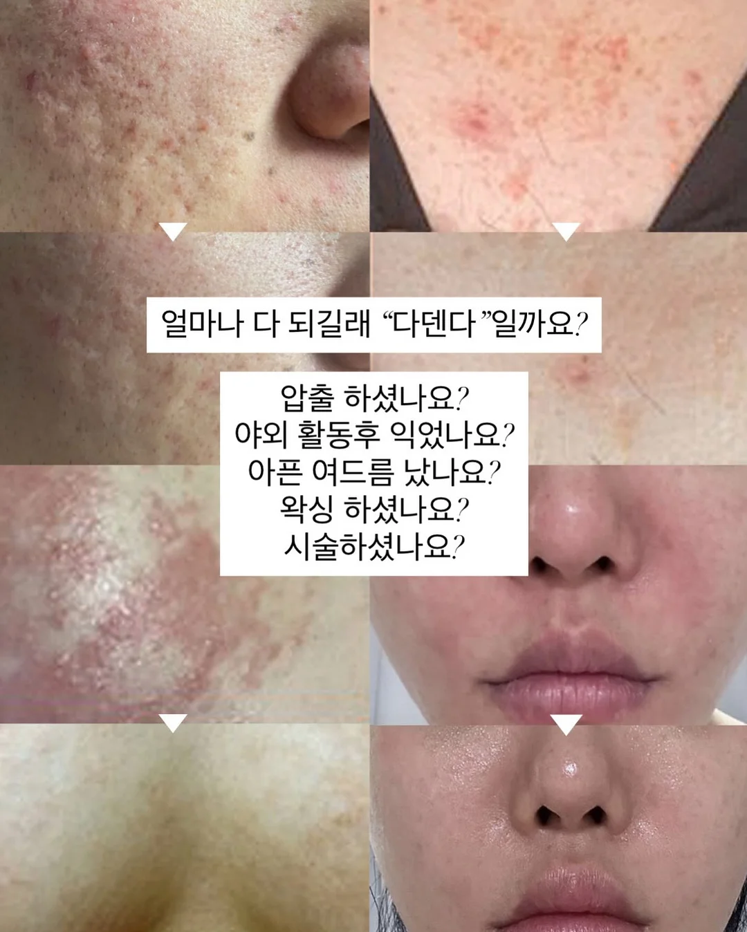 방구석 홈트 기구 5
