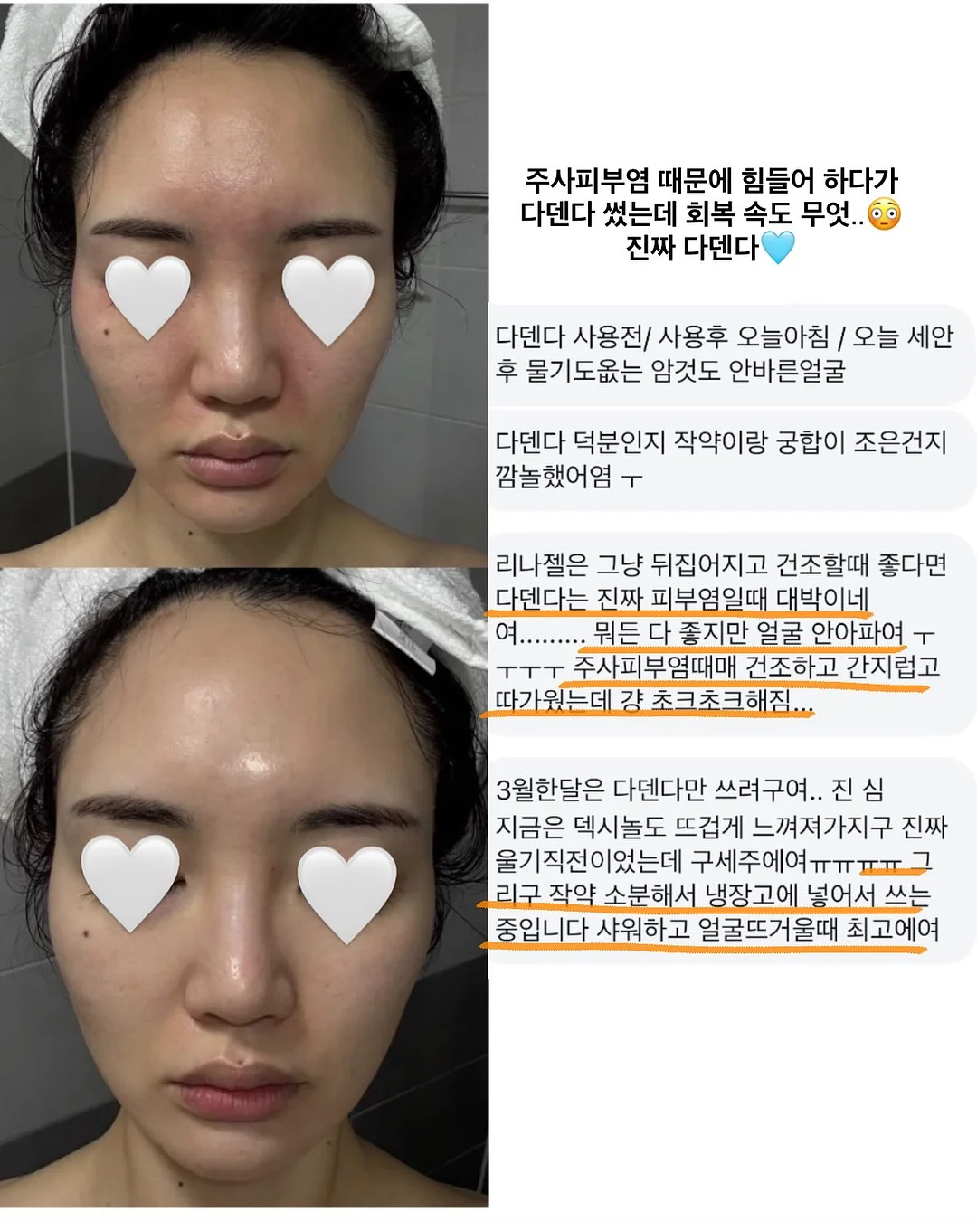 방구석 홈트 기구 6