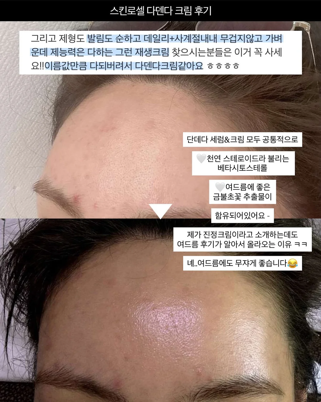 방구석 홈트 기구 9