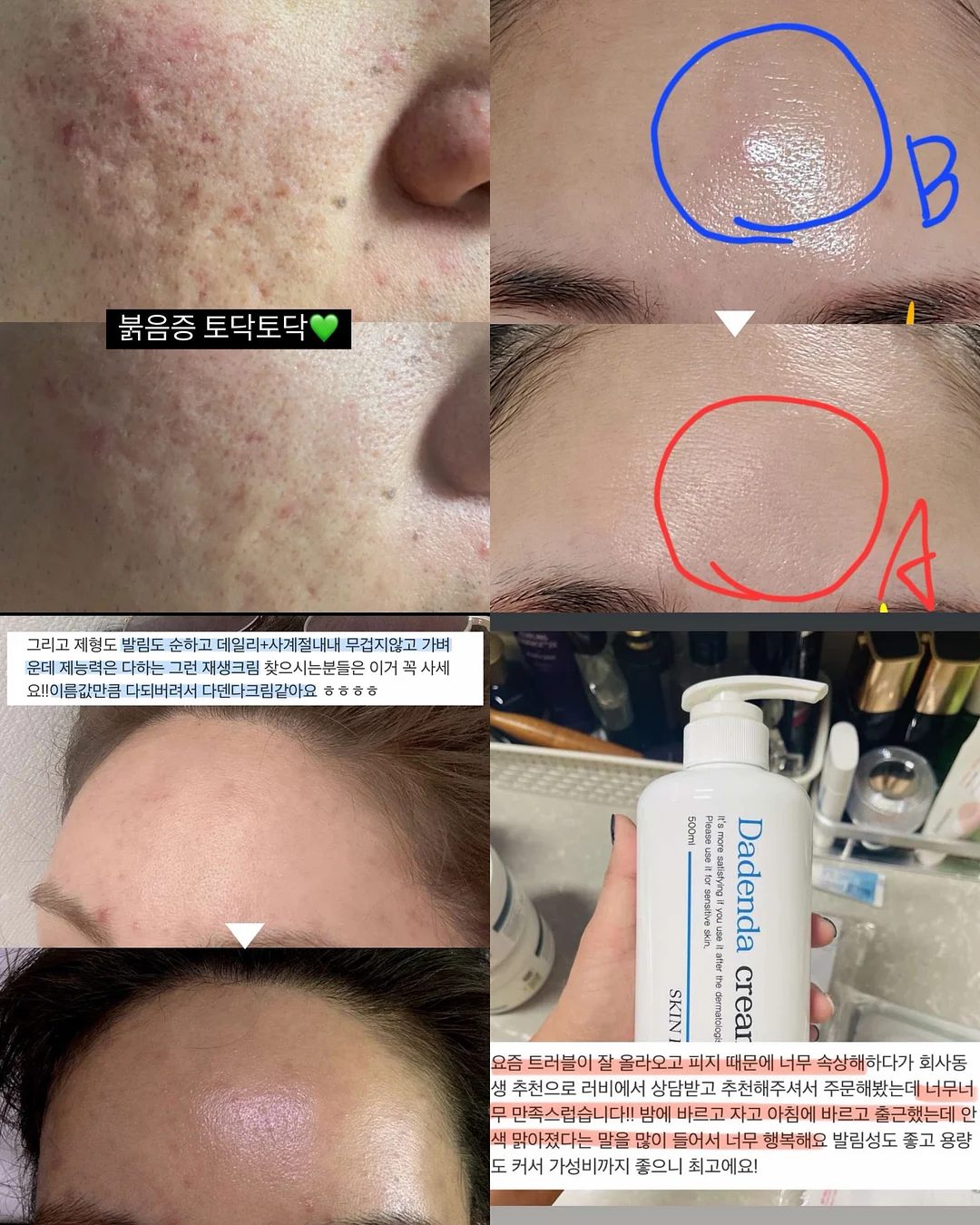 방구석 홈트 기구 10