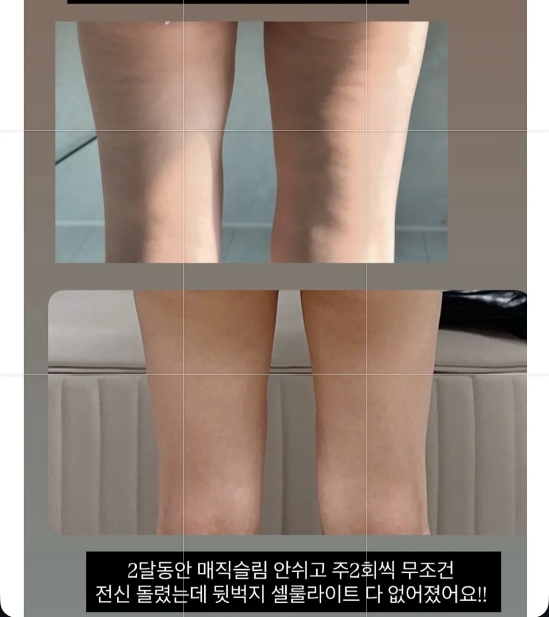 프리바이오틱스 2