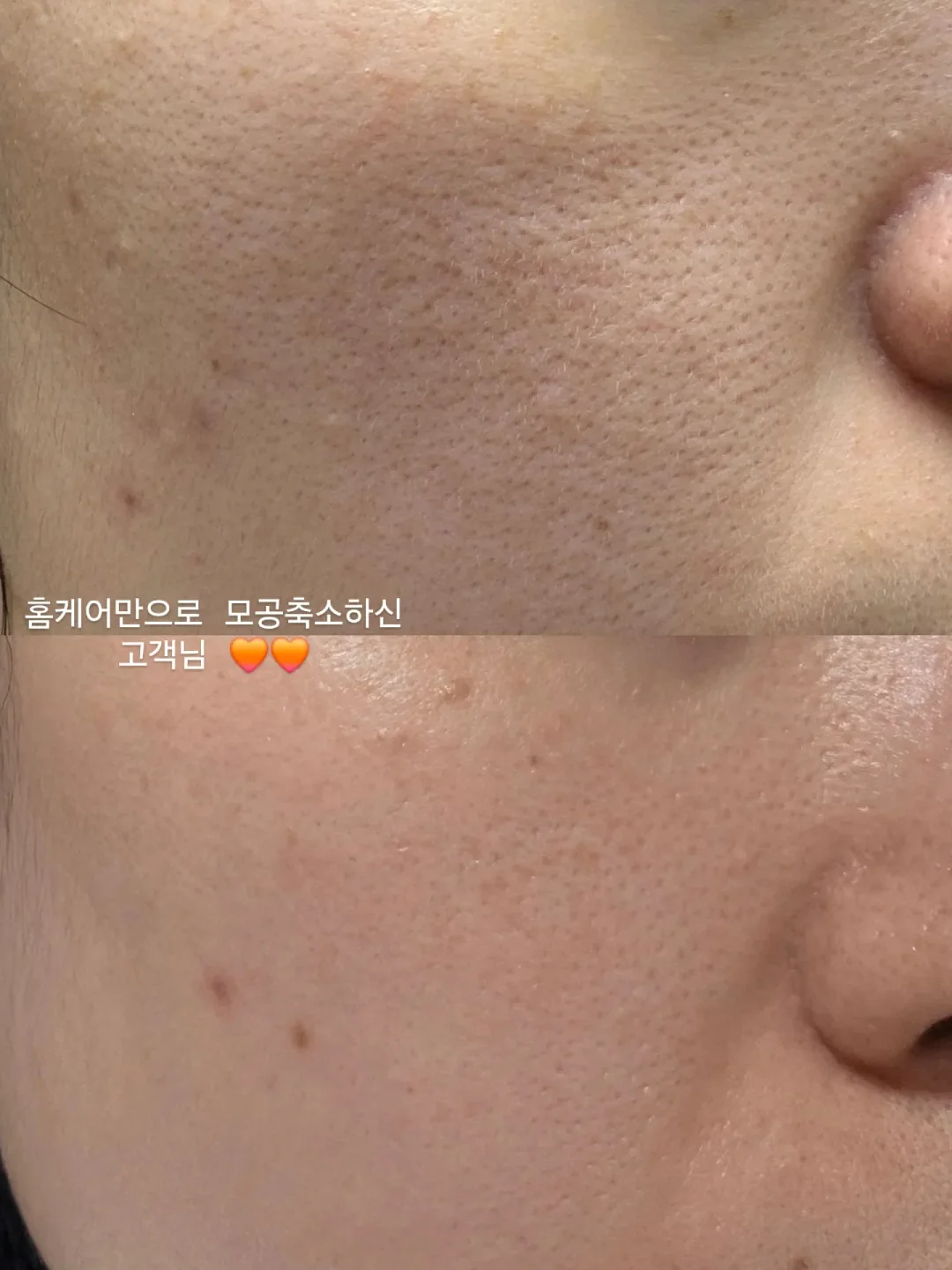 이너 슬립 가디건 세트 1