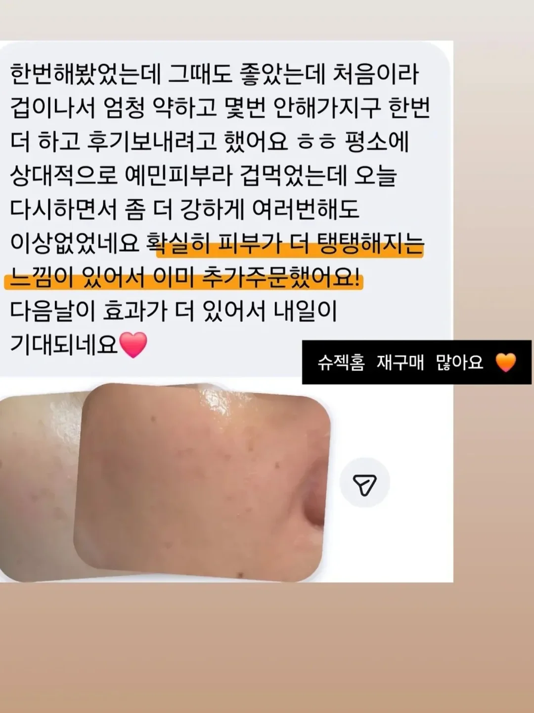 이너 슬립 가디건 세트 5