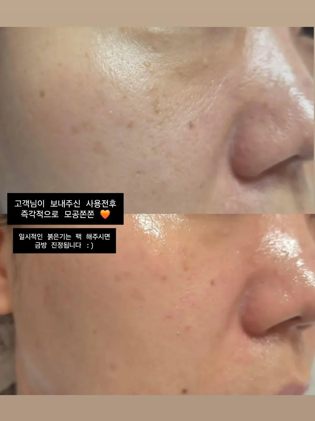 이너 슬립 가디건 세트 6