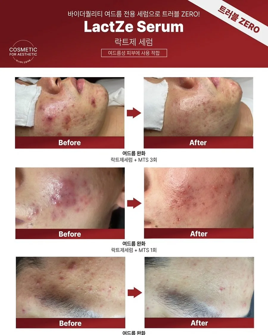 보그백 11