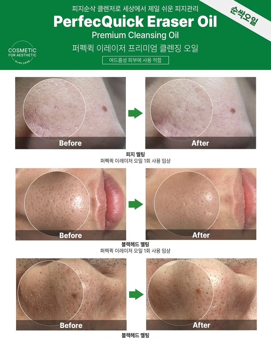 보그백 3