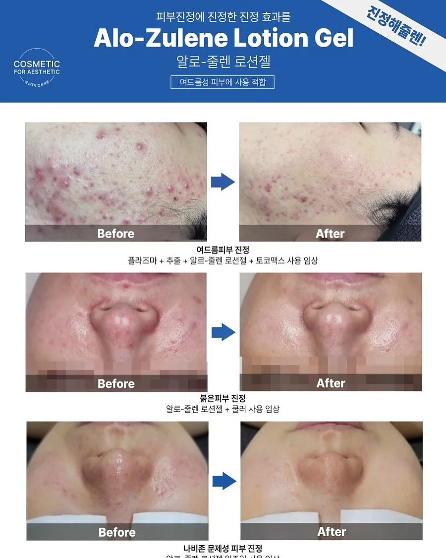 보그백 9