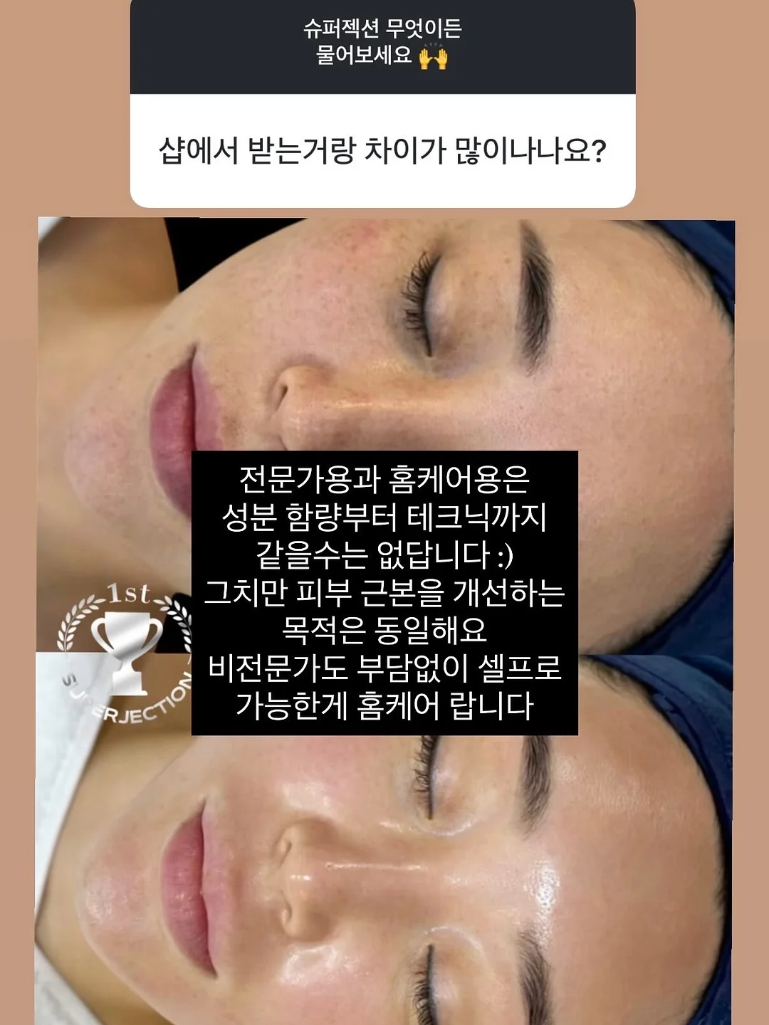 실루엣 중심 후들거리는 쉬어한 소재 의류 2